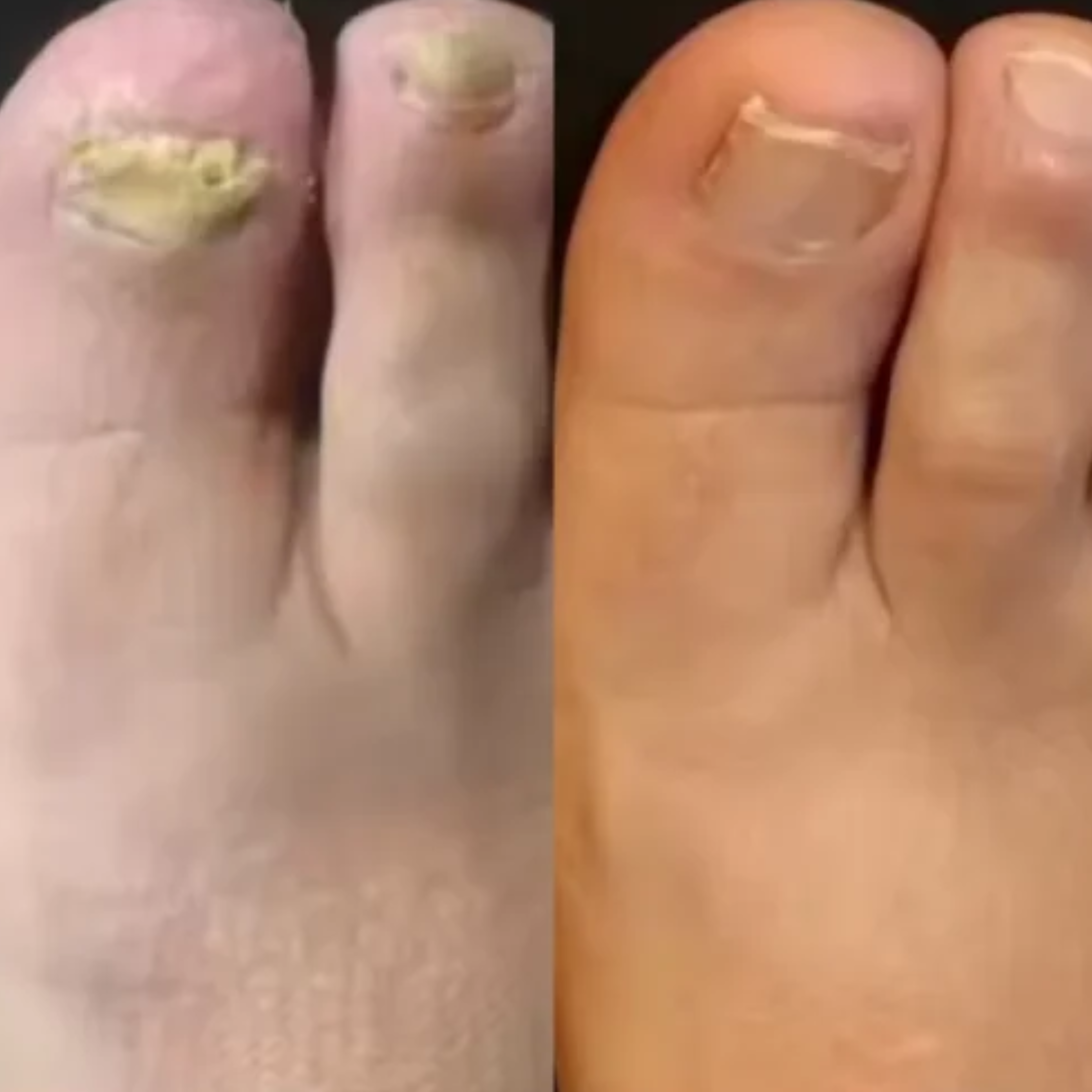 Lumora Beam reviews Ryan M.